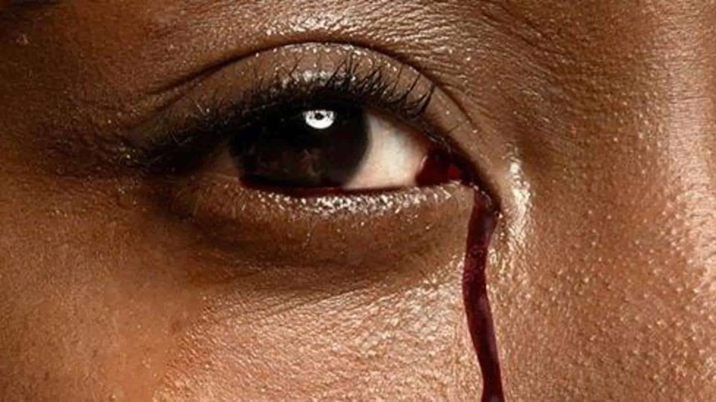 लड़की की आंखों से गिरता है आंसू की तरह Blood