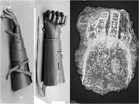 मध्यकालीन युग का Prosthetic हैंड खोजा