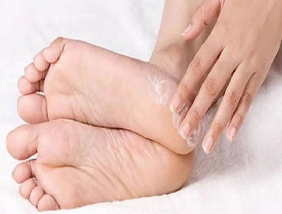 Cracked Heels ठीक करने अपनायें ये तरीके