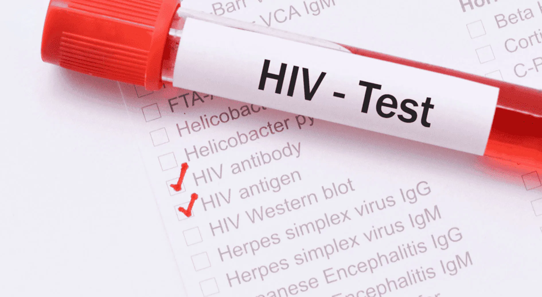 आ गया HIV का टीका, साल में दो बार लगेगा 100 फीसदी देगा सुरक्षा