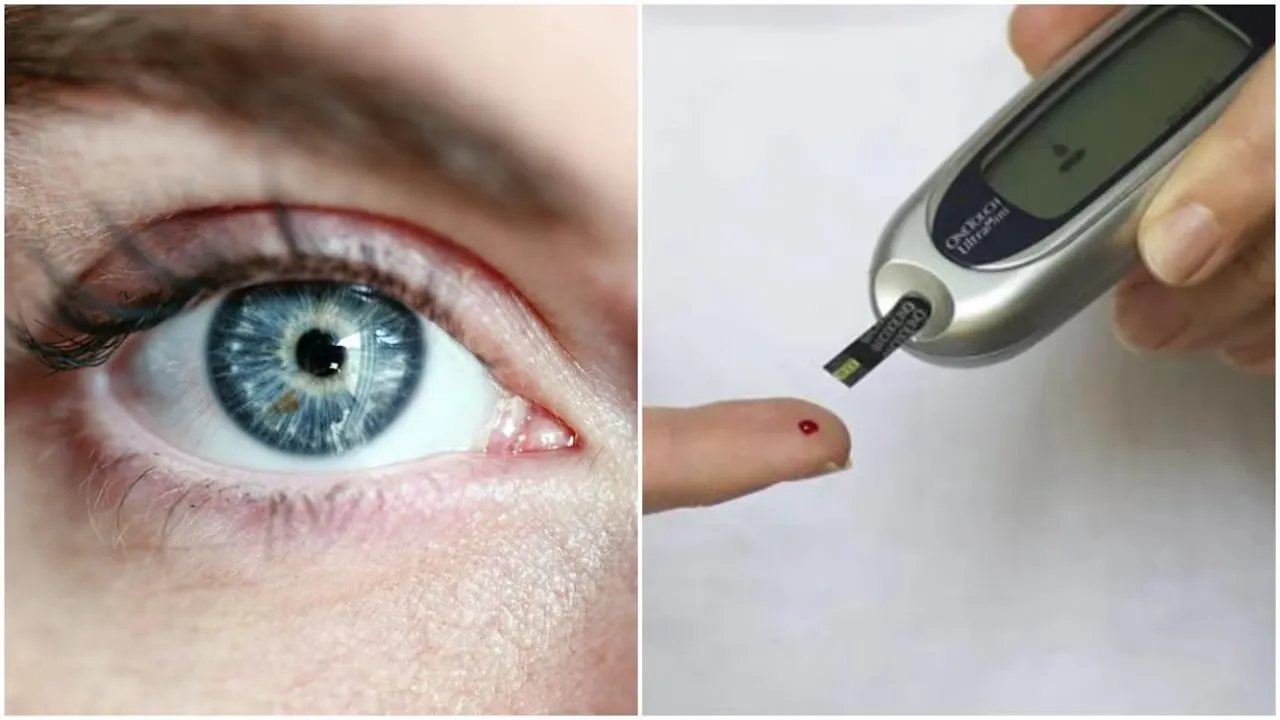 रेटिना का पतला होना टाइप 2 Diabetes के हो सकते हैं संकेत