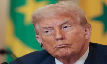 Trump की नसें पड़ने लगीं काली, ये बीमारी कैसे होती है और कितनी खतरनाक है